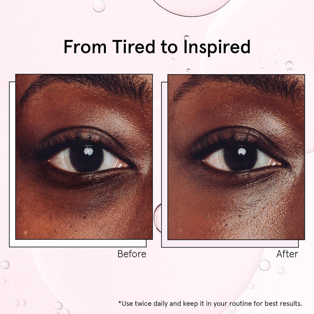 grace & stella Award Winning Under Eye Brightener with Rose Quartz Rollerball - Centella Asiatica & Caffeine Under Eye Serum for Dark Circles & Puffiness - Travel Essentials, Vegan (15ml/0.51floz)