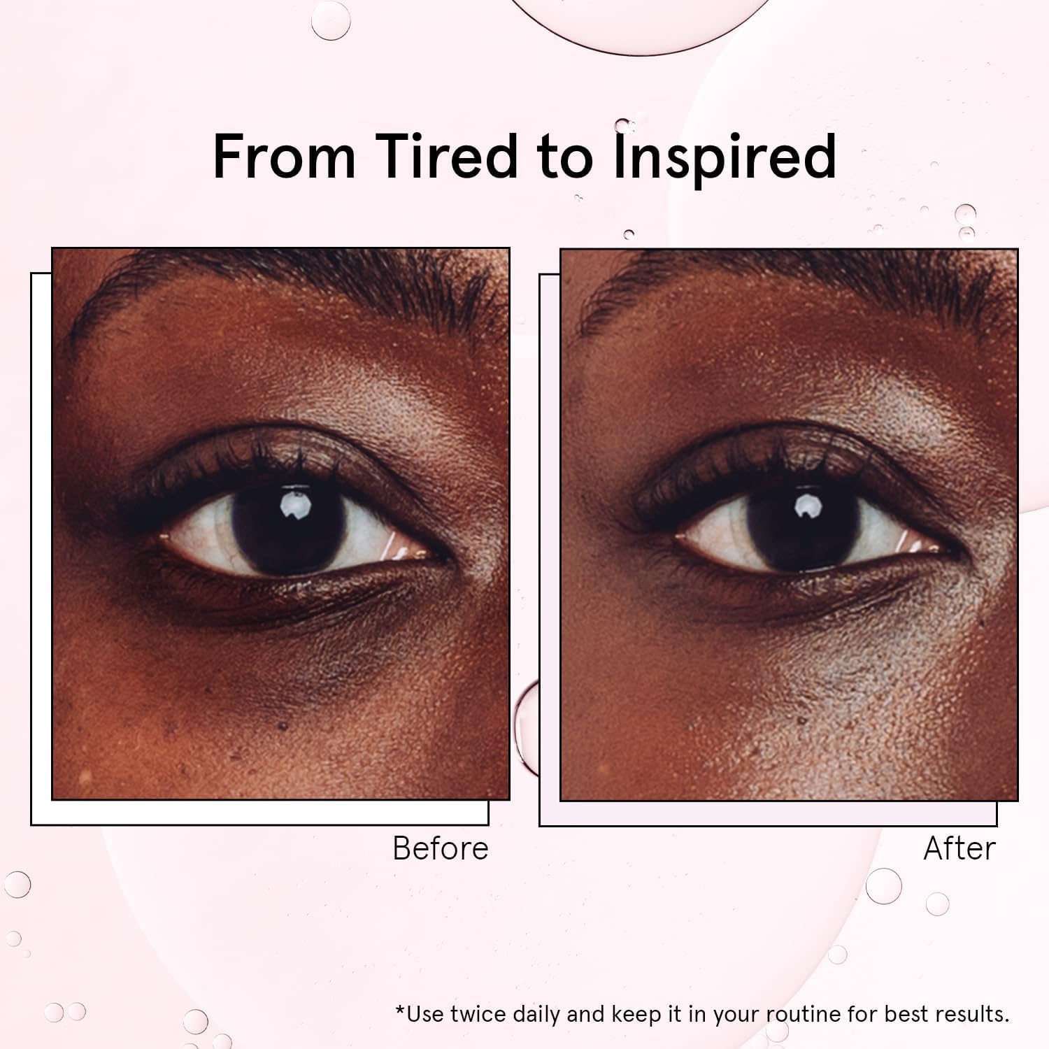 grace & stella Award Winning Under Eye Brightener with Rose Quartz Rollerball - Centella Asiatica & Caffeine Under Eye Serum for Dark Circles & Puffiness - Travel Essentials, Vegan (15ml/0.51floz)