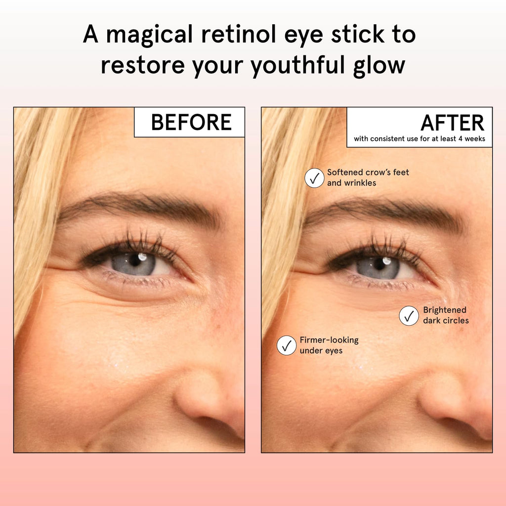 grace & stella Retinol & Caffeine Under Eye Serum Anti Aging | Hydrating Cream with Niacinamide, Peptides - Reduce Wrinkles, Crow's Feet, Puffiness - Vegan Skincare (0.5 floz/15ml)