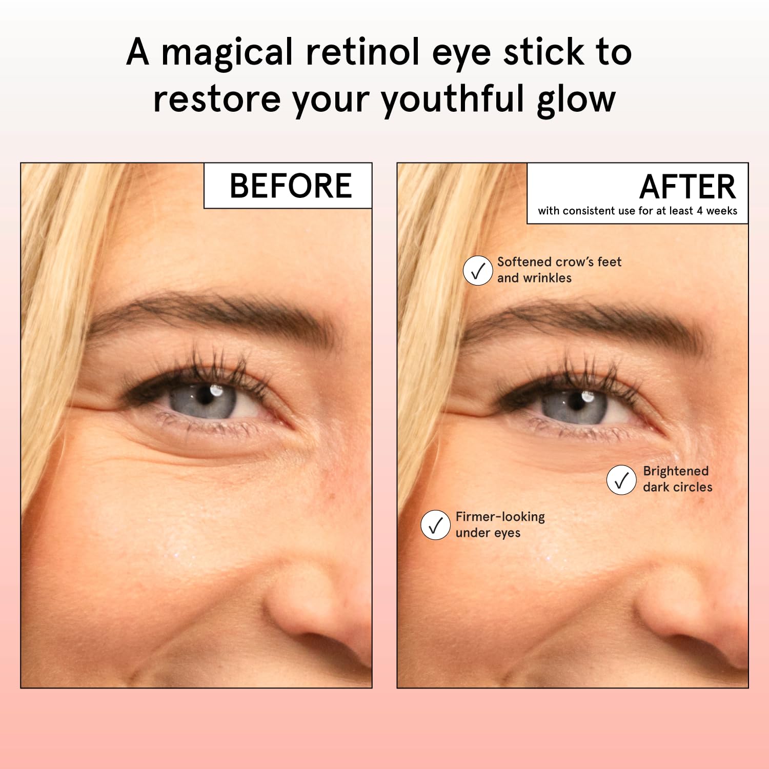 grace & stella Retinol & Caffeine Under Eye Serum Anti Aging | Hydrating Cream with Niacinamide, Peptides - Reduce Wrinkles, Crow's Feet, Puffiness - Vegan Skincare (0.5 floz/15ml)