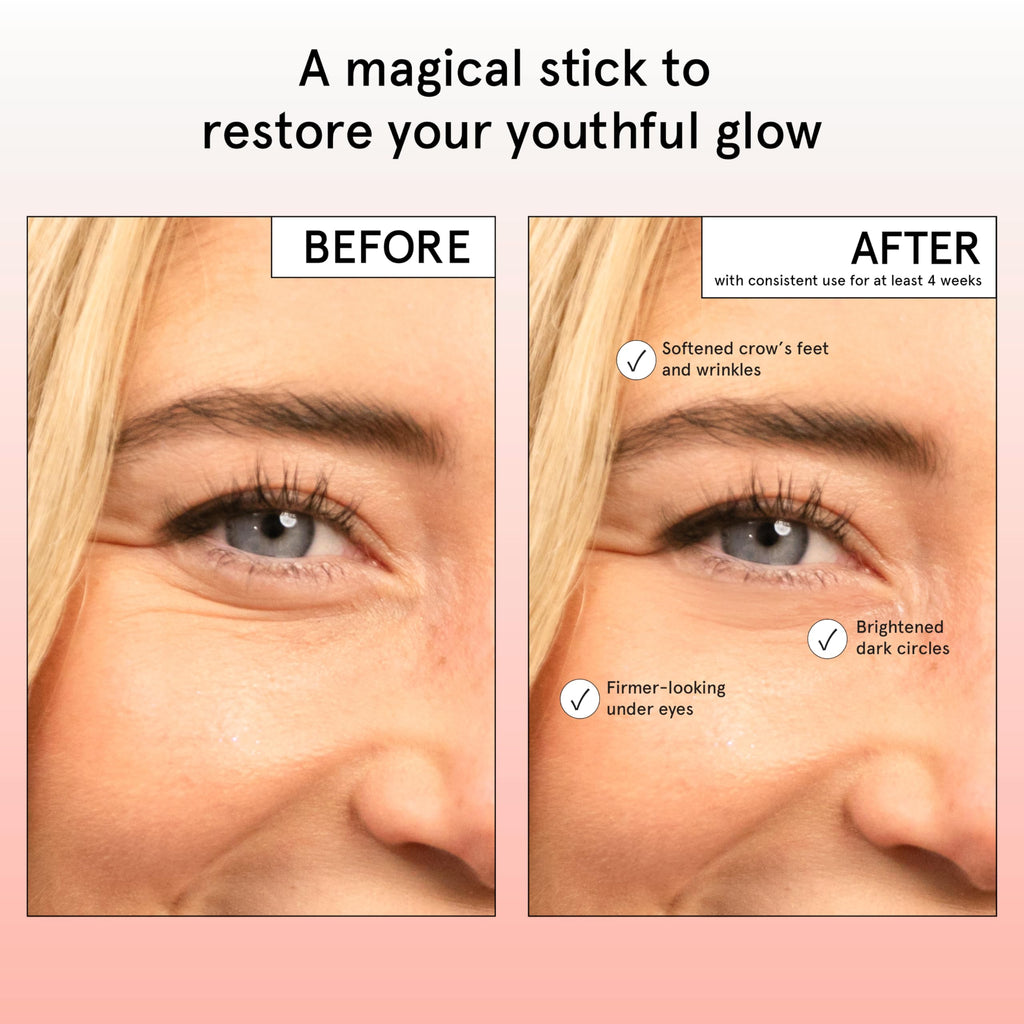 grace & stella Retinol & Caffeine Under Eye Serum Anti Aging | Hydrating Cream with Niacinamide, Peptides - Reduce Wrinkles, Crow's Feet, Puffiness - Vegan Skincare (0.5 floz/15ml)